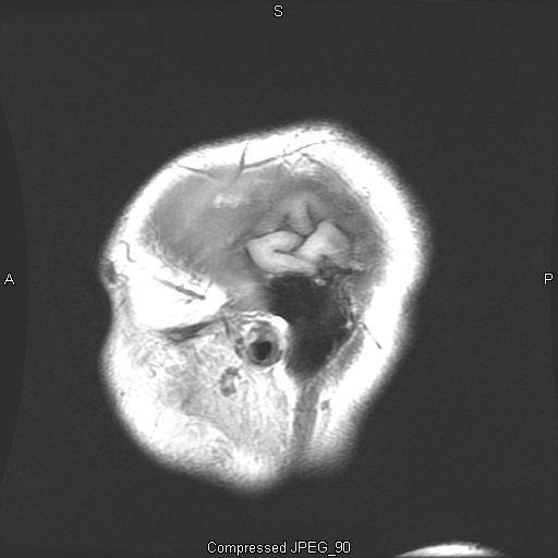 MRI Album 1 Pic 2